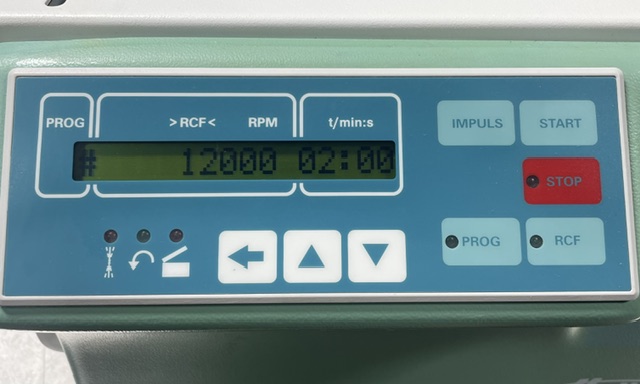 Hettich Mikro 22 Centrifuge - 18,000 RPM, 24x1.5ml, 21,000 RCF - Image 5